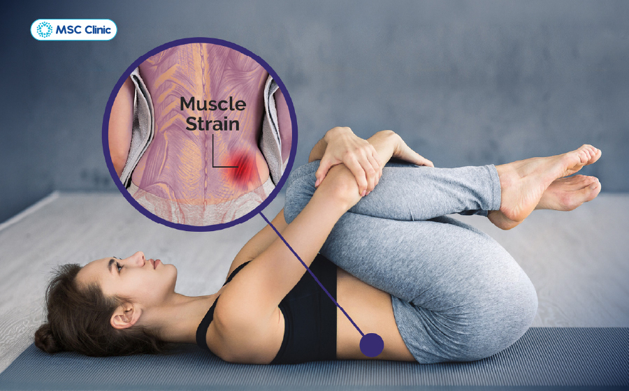 Các bài tập phục hồi căng cơ lưng giúp cải thiện sự linh hoạt và giảm nguy cơ tái phát Các bài tập phục hồi căng cơ lưng giúp cải thiện sự linh hoạt và giảm nguy cơ tái phát