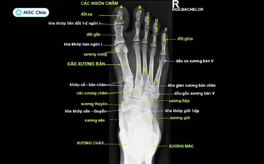 Cấu tạo khớp ngón chân Cấu tạo khớp ngón chân
