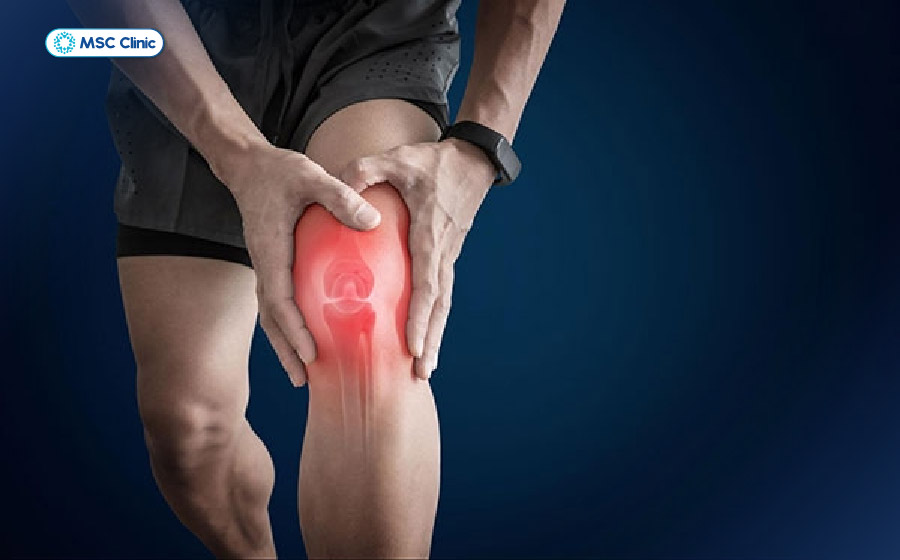 Chấn thương thể thao cường độ cao là nguyên nhân dẫn đến gãy mâm chày