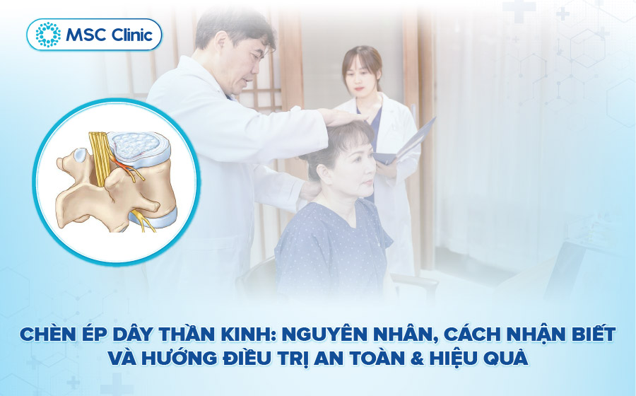 Chèn ép dây thần kinh: Nguyên nhân, nhận biết và điều trị