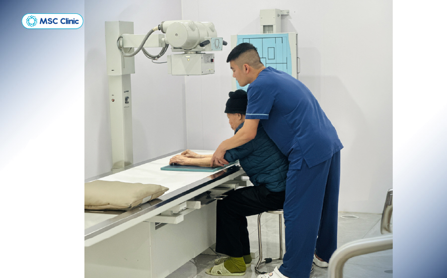 Chụp X-quang là bước cần thiết để loại trừ các tổn thương xương liên quan đến đau cơ ở bắp tay