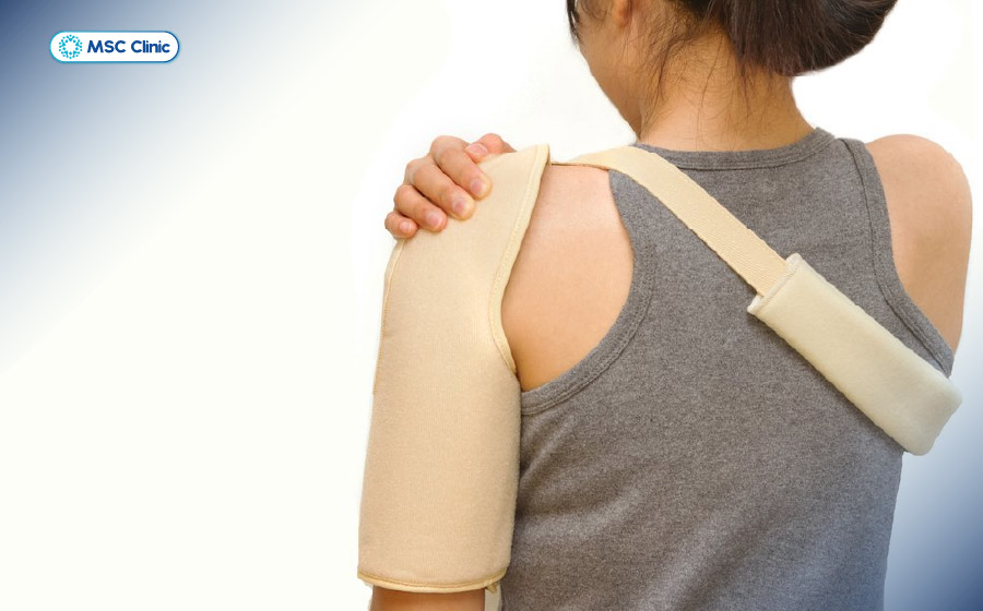 Cố định cánh tay bằng đai treo là biện pháp sơ cứu thường được áp dụng khi nghi ngờ trật khớp vai