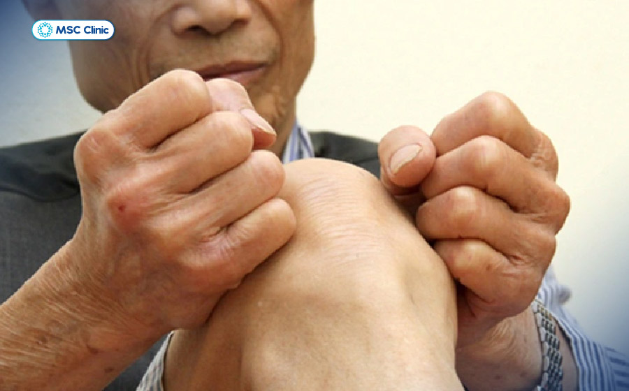 Cứng khớp gối gây ra sự bất tiện trong sinh hoạt hàng ngày