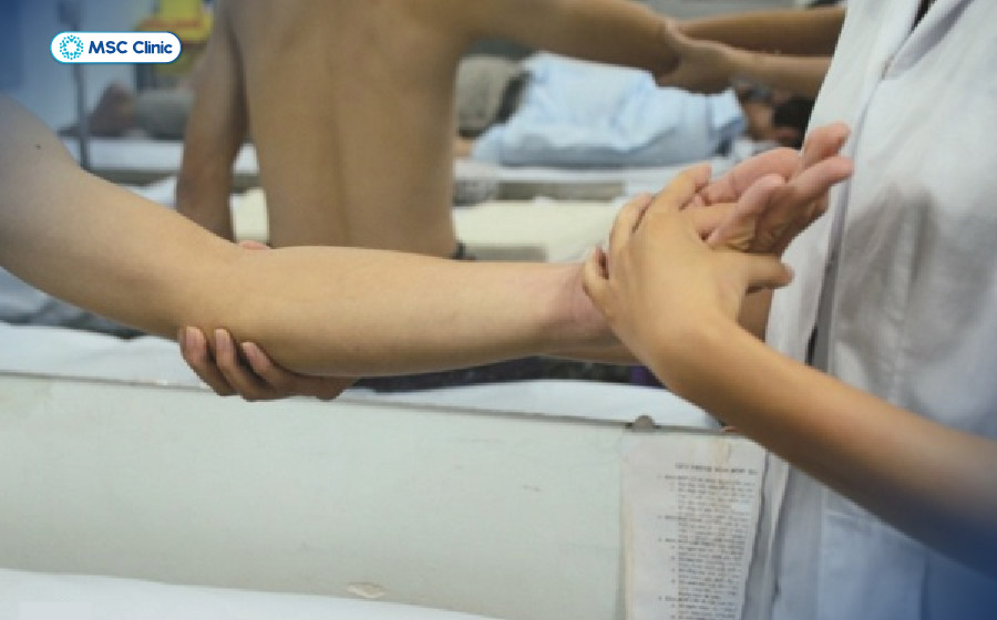 Cứng khớp và khó gập duỗi khiến sinh hoạt hàng ngày trở nên khó khăn 