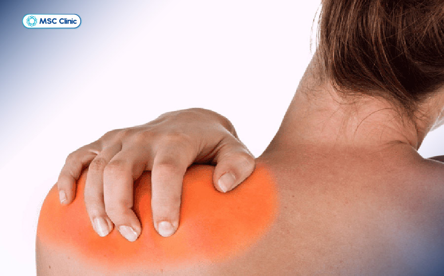 Đau bả vai thường đi kèm với các triệu chứng như nhức, mỏi, hạn chế vận động