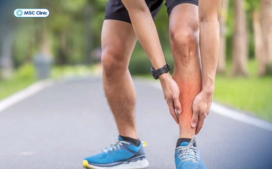 Đau bắp chân là tình huống thường gặp trong cuộc sống mà ít người chú ý đến Đau bắp chân là tình huống thường gặp trong cuộc sống mà ít người chú ý đến