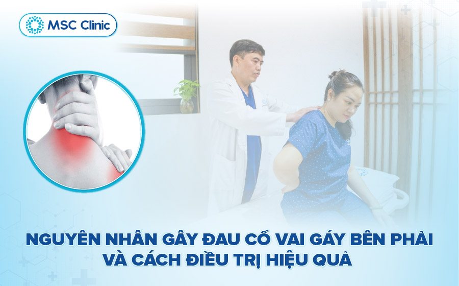 Đau cổ vai gáy bên phải: Nguyên nhân và chữa trị hiệu quả