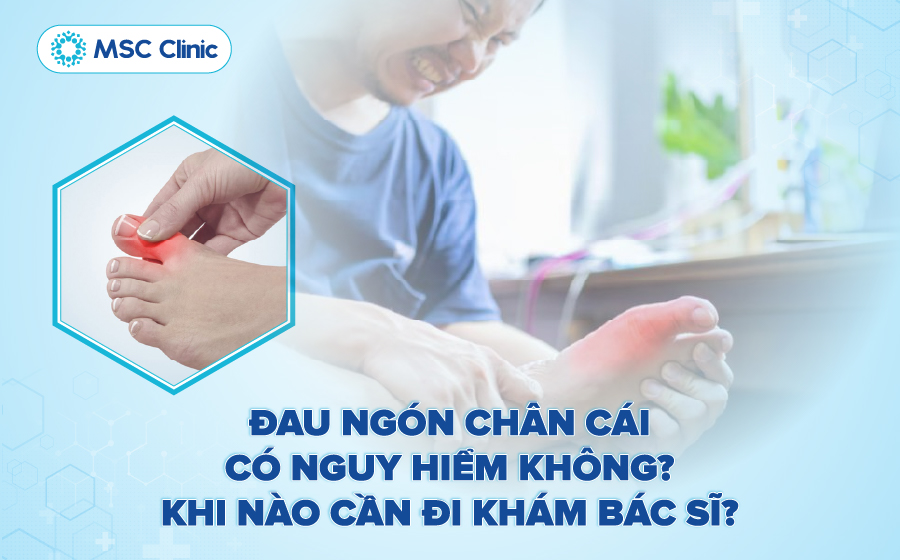 Tìm hiểu đau ngón chân cái có nguy hiểm không và khi nào cần đi khám Tìm hiểu đau ngón chân cái có nguy hiểm không và khi nào cần đi khám