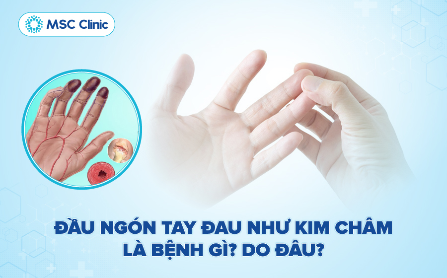 Đầu ngón tay đau như kim châm là bệnh gì? Do đâu?
