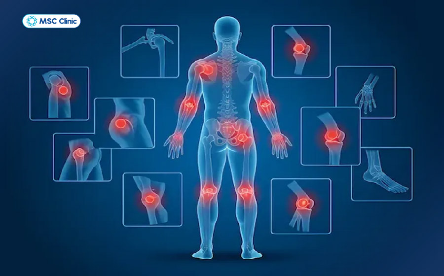 Đau nhức xương khớp toàn thân có thể là dấu hiệu cảnh báo các bệnh lý cơ xương khớp