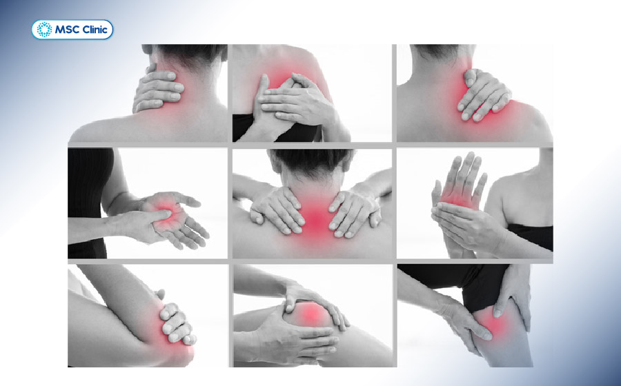 Đau nhức xương khớp toàn thân là tình trạng đau xuất hiện nhiều vị trí, gây khó chịu kéo dài