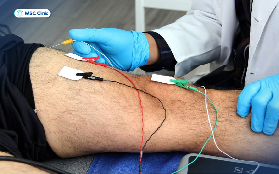 Đo điện cơ giúp chẩn đoán tê chân do các bệnh lý chèn ép thần kinh hoặc rối loạn chức năng cơ 