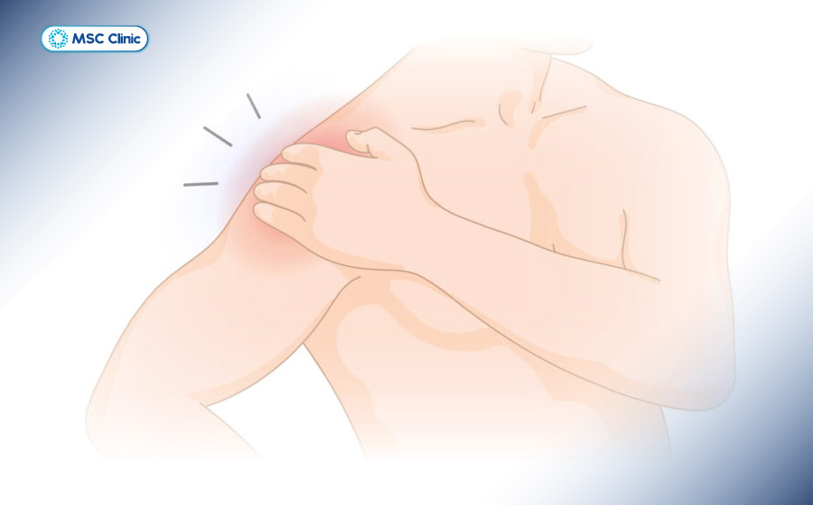 Khớp vai kêu lục cục có thể là dấu hiệu bệnh lý cơ xương khớp Khớp vai kêu lục cục có thể là dấu hiệu bệnh lý cơ xương khớp