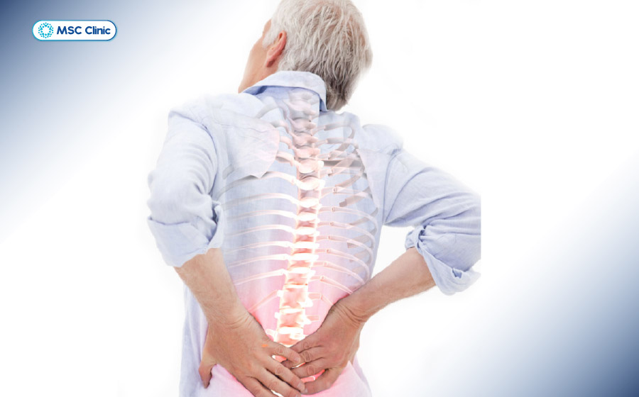 Lão hóa tuổi tác là nguyên nhân hàng đầu dẫn đến tình trạng lắng đọng tích tụ canxi ở cột sống Lão hóa tuổi tác là nguyên nhân hàng đầu dẫn đến tình trạng lắng đọng tích tụ canxi ở cột sống