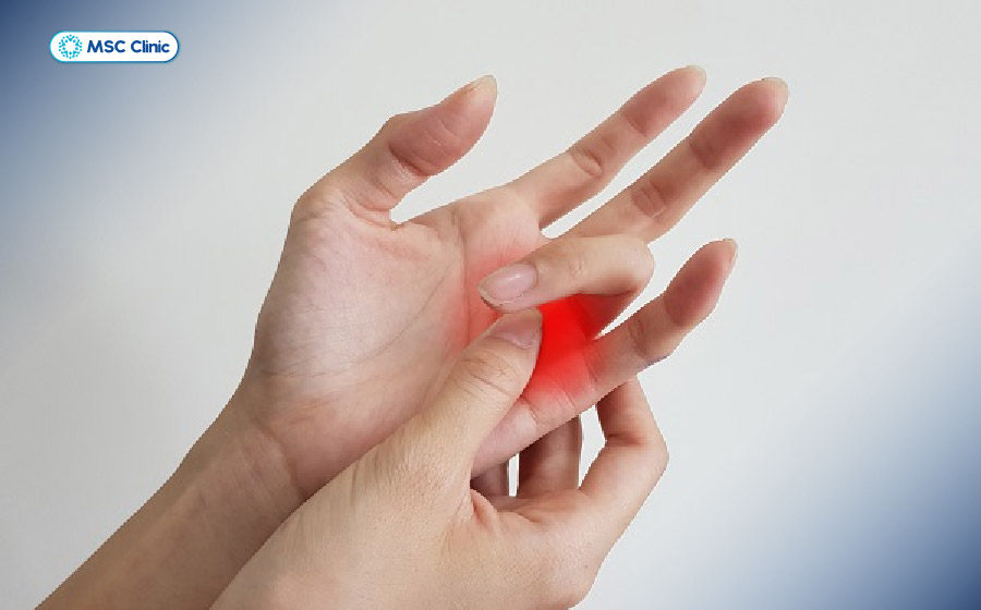 Ngón tay có thể bị kẹt ở tư thế gập, sau đó bật thẳng đột ngột khi người bệnh cố duỗi ra
