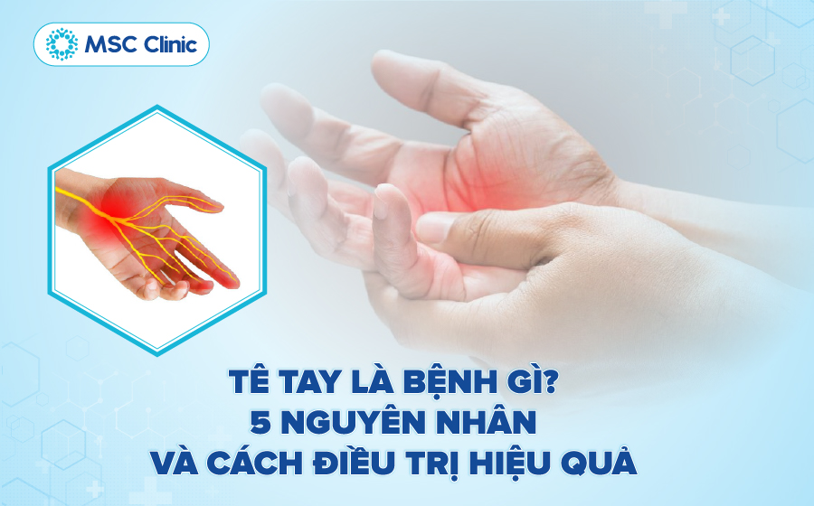 Tìm hiểu người bị tê tay thường có dấu hiệu thế nào, nguyên nhân do đâu
