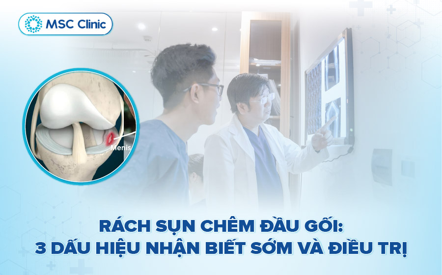 Rách sụn chêm đầu gối: 3 dấu hiệu nhận biết sớm và điều trị