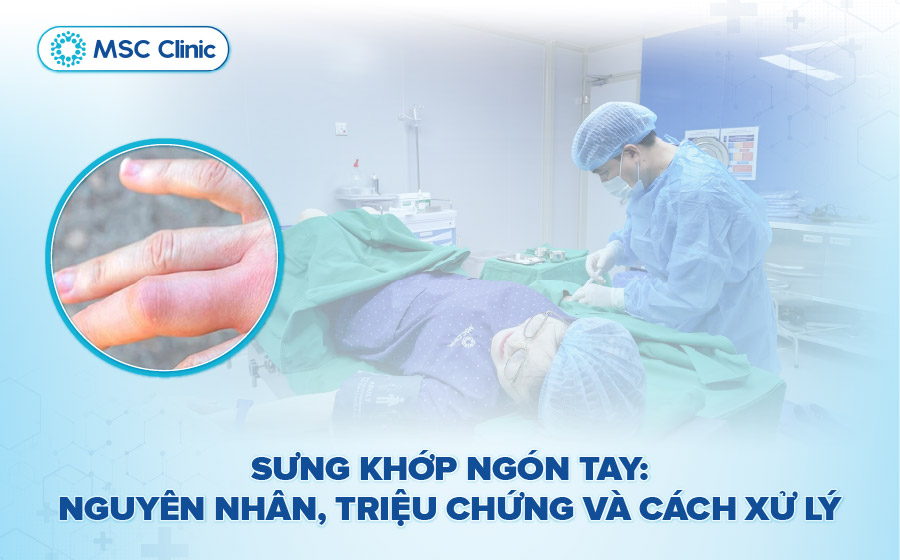 Sưng khớp ngón tay: Nguyên nhân, triệu chứng và cách xử lý