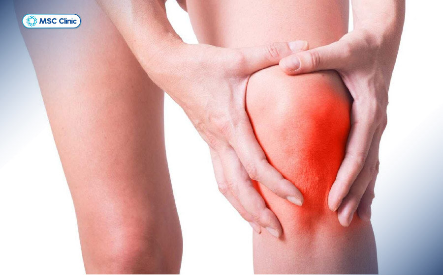 Sưng nóng và đau quanh khớp gối là dấu hiệu cần thăm khám sớm 