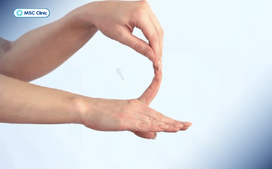 Tập căng duỗi ngón tay bằng cách dùng tay khỏe tác động lên ngón tay bị kẹt