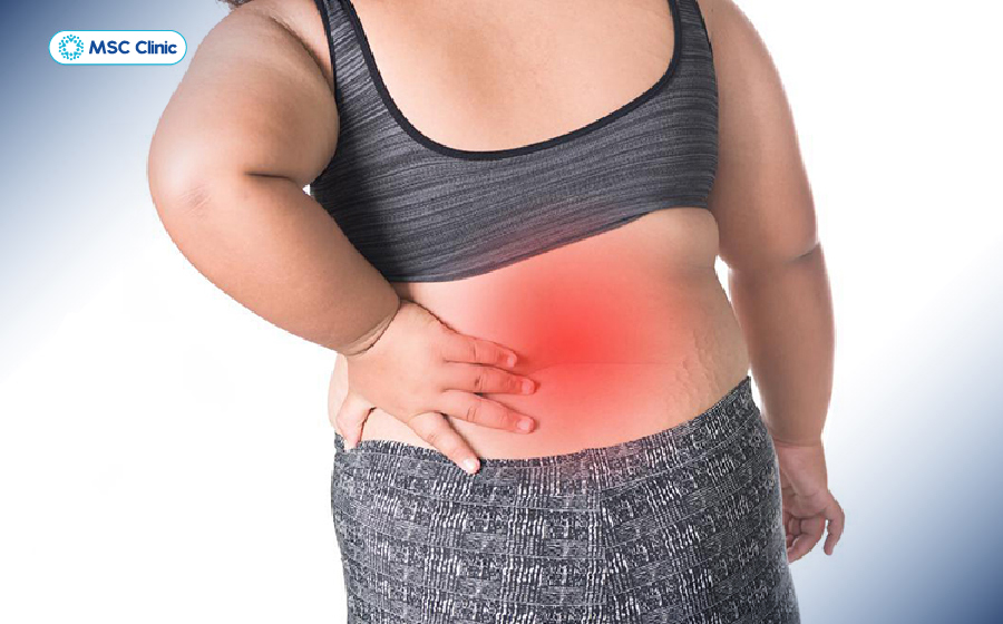 Thừa cân, béo phì làm tăng gánh nặng cho cột sống và gây ra các cơn đau thắt lưng Thừa cân, béo phì làm tăng gánh nặng cho cột sống và gây ra các cơn đau thắt lưng