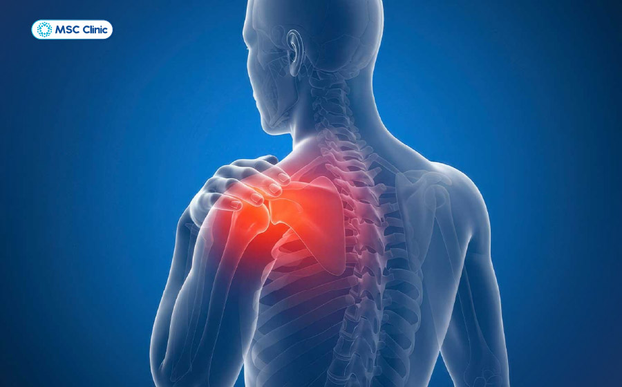 Tình trạng đông cứng khớp vai khiến khớp vai bị đau và cứng dần theo thời gian Tình trạng đông cứng khớp vai khiến khớp vai bị đau và cứng dần theo thời gian