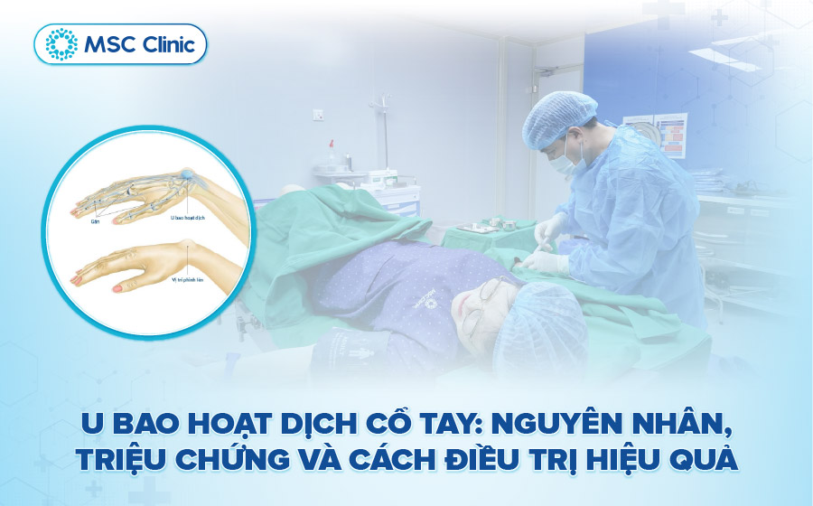 U bao hoạt dịch cổ tay là gì? Nguyên nhân và mẹo chữa trị