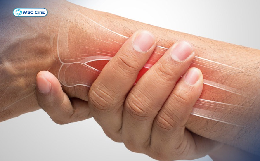 Viêm khớp dạng thấp là một trong những nguyên nhân phổ biến dẫn đến đau cổ tay kéo dài Viêm khớp dạng thấp là một trong những nguyên nhân phổ biến dẫn đến đau cổ tay kéo dài