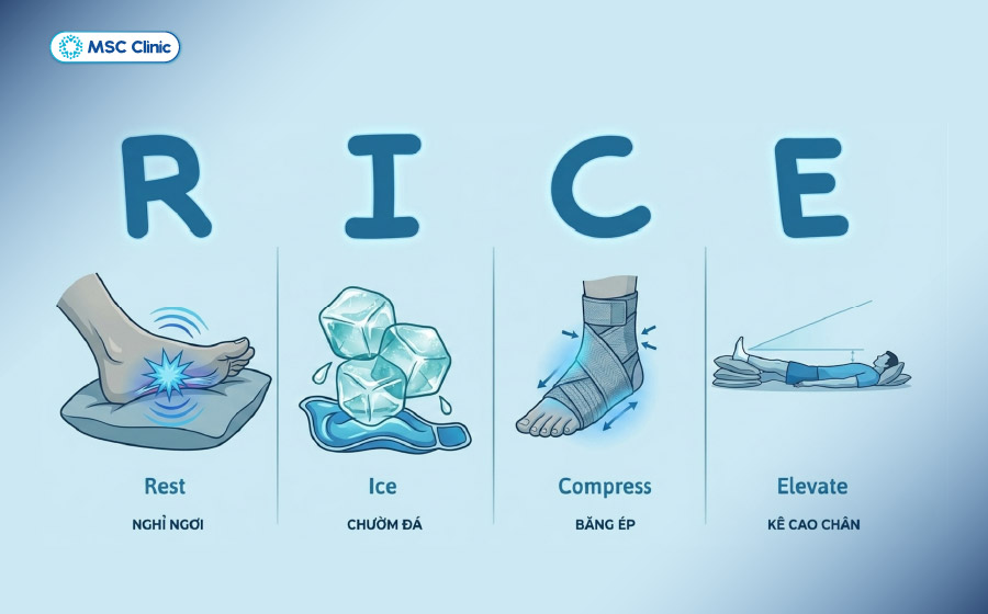 Áp dụng sớm nguyên tắc R.I.C.E có thể giúp kiểm soát triệu chứng và hỗ trợ quá trình hồi phục hiệu quả hơn Áp dụng sớm nguyên tắc R.I.C.E có thể giúp kiểm soát triệu chứng và hỗ trợ quá trình hồi phục hiệu quả hơn