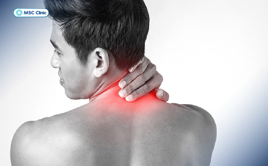 Căng cơ cổ gây ra những cơn đau nhức khi cử động