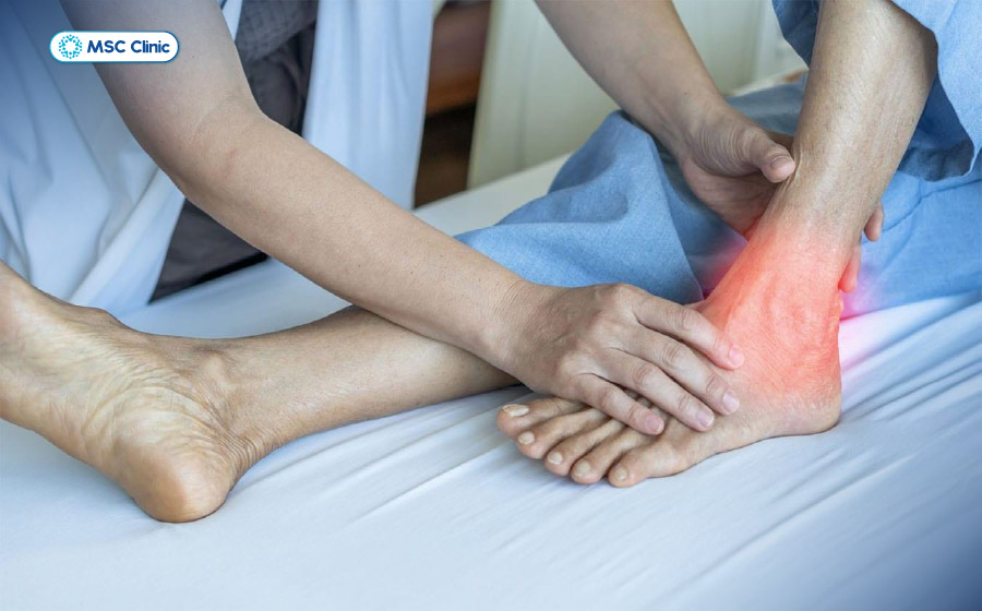 Chấn thương gãy mắt cá chân cần được xử lý đúng cách Chấn thương gãy mắt cá chân cần được xử lý đúng cách