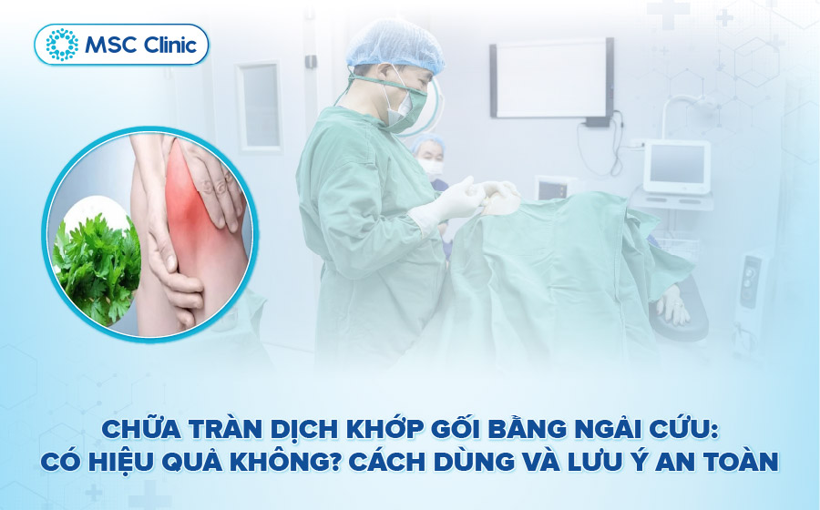 Chữa tràn dịch khớp gối bằng ngải cứu hiệu quả không? Lưu ý