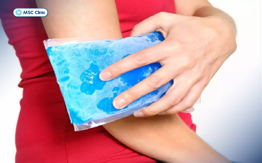 Chườm đá lạnh có thể giúp giảm sưng viêm vùng bắp tay