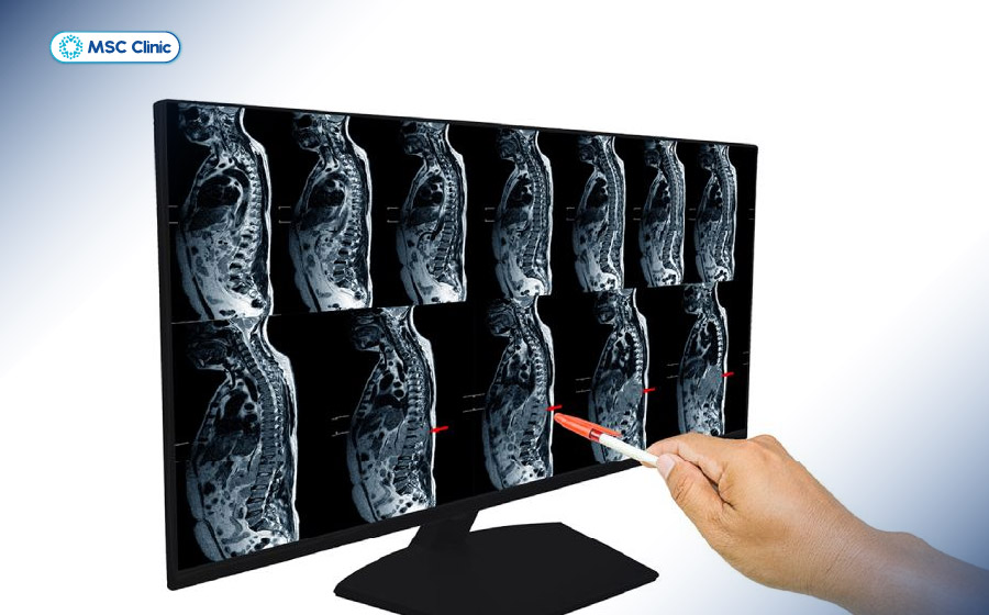 Chụp MRI có cần nhịn ăn không? Câu trả lời là không, trong trường hợp chụp MRI cột sống Chụp MRI có cần nhịn ăn không? Câu trả lời là không, trong trường hợp chụp MRI cột sống