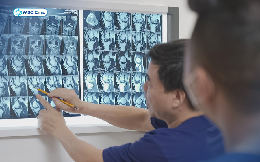 Chụp X-quang là phương pháp đầu tay giúp xác định vị trí gãy, mức độ di lệch và đặc điểm tổn thương của xương bánh chè