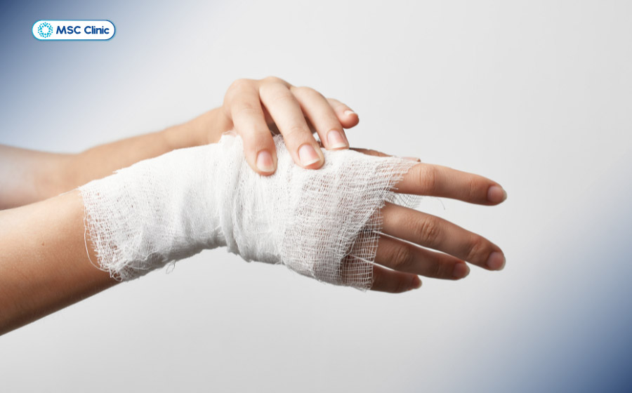Cố định tay giúp xương sớm hồi phục ổn định Cố định tay giúp xương sớm hồi phục ổn định