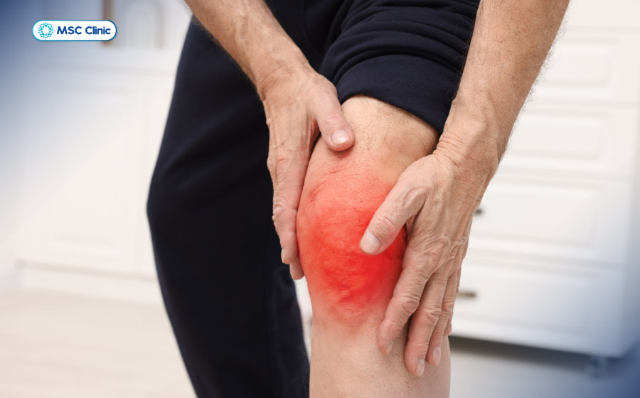 Đau đầu gối gây đau nhức, hạn chế vận động và làm giảm chất lượng sống Đau đầu gối gây đau nhức, hạn chế vận động và làm giảm chất lượng sống