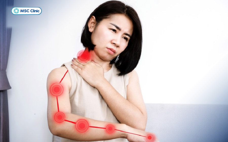 Đau lan theo đường đi của dây thần kinh là triệu chứng đặc trưng của hội chứng rễ thần kinh