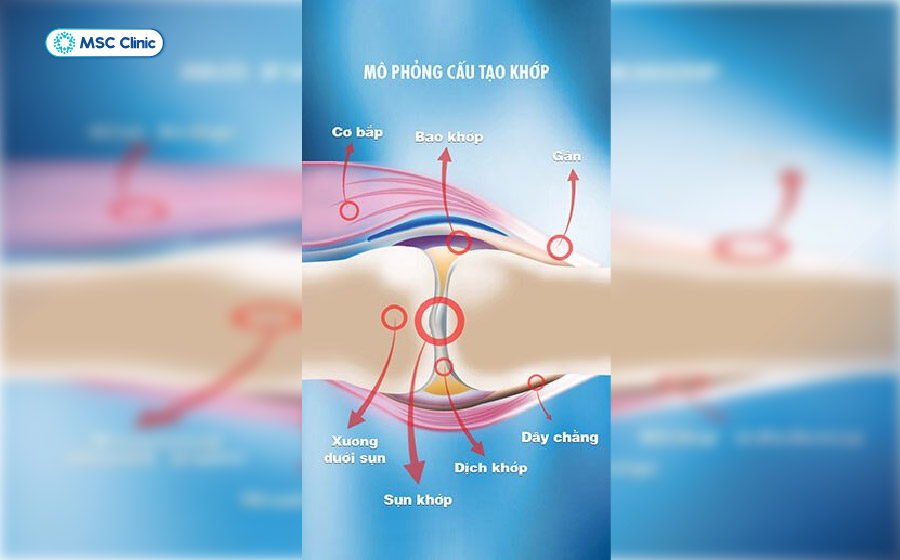 Dịch khớp hoạt động như lớp đệm bôi trơn giữa hai đầu xương Dịch khớp hoạt động như lớp đệm bôi trơn giữa hai đầu xương