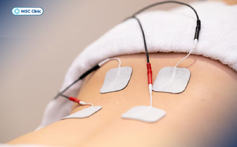 Điện xung là một kỹ thuật vật lý trị liệu thường được sử dụng để hỗ trợ giảm đau lưng không do chấn thương cấp tính Điện xung là một kỹ thuật vật lý trị liệu thường được sử dụng để hỗ trợ giảm đau lưng không do chấn thương cấp tính