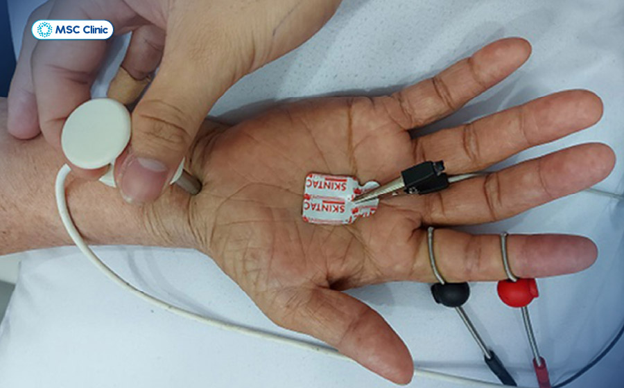 Đo dẫn truyền thần kinh giúp đánh giá chức năng dẫn truyền thần kinh và xác định vị trí dây thần kinh bị chèn ép