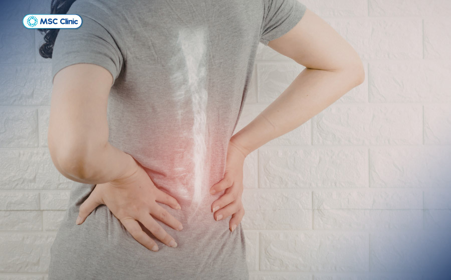 Hẹp ống sống gây đau nhức, tê bì và hạn chế vận động kéo dài