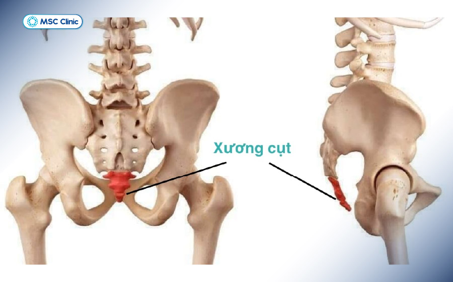 Hình ảnh mô phỏng vị trí xương cụt Hình ảnh mô phỏng vị trí xương cụt