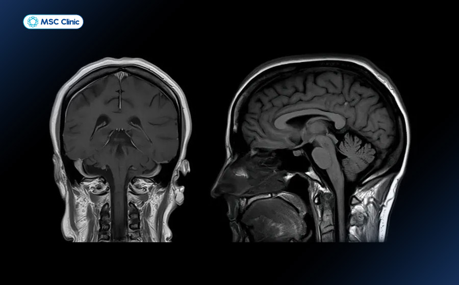 Hình ảnh từ máy chụp MRI Hình ảnh từ máy chụp MRI