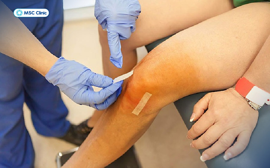 Khớp gối sưng đau kéo dài, tái phát nhiều lần hoặc hạn chế vận động là những dấu hiệu người bệnh nên thăm khám chuyên khoa 