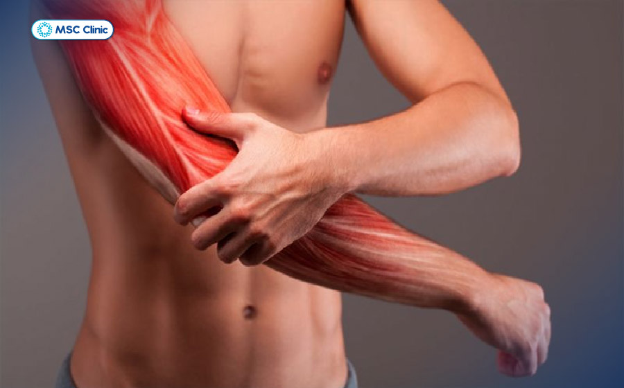 Mỏi cơ là gì là vấn đề được nhiều người quan tâm