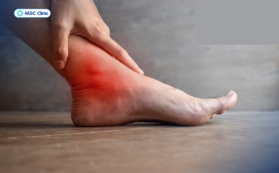 Ngủ dậy bị đau khớp cổ chân có thể liên quan đến nhiều nguyên nhân khác nhau Ngủ dậy bị đau khớp cổ chân có thể liên quan đến nhiều nguyên nhân khác nhau