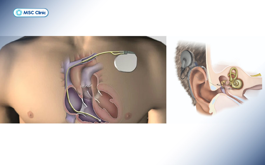 Người bệnh cần tháo toàn bộ vật dụng kim loại trước khi vào phòng chụp MRI để đảm bảo an toàn Người bệnh cần tháo toàn bộ vật dụng kim loại trước khi vào phòng chụp MRI để đảm bảo an toàn
