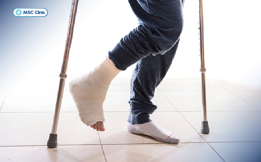 Người bệnh cần tránh tạo áp lực trực tiếp lên chân đau trong thời gian đầu Người bệnh cần tránh tạo áp lực trực tiếp lên chân đau trong thời gian đầu