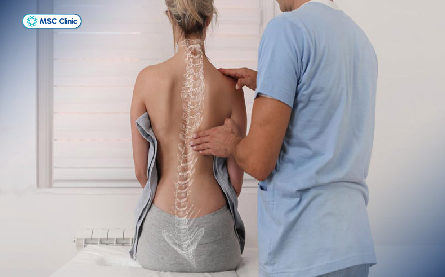 Người bị cong vẹo cột sống thường có vai mất cân bằng